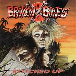 Broken Bones : Stiched Up